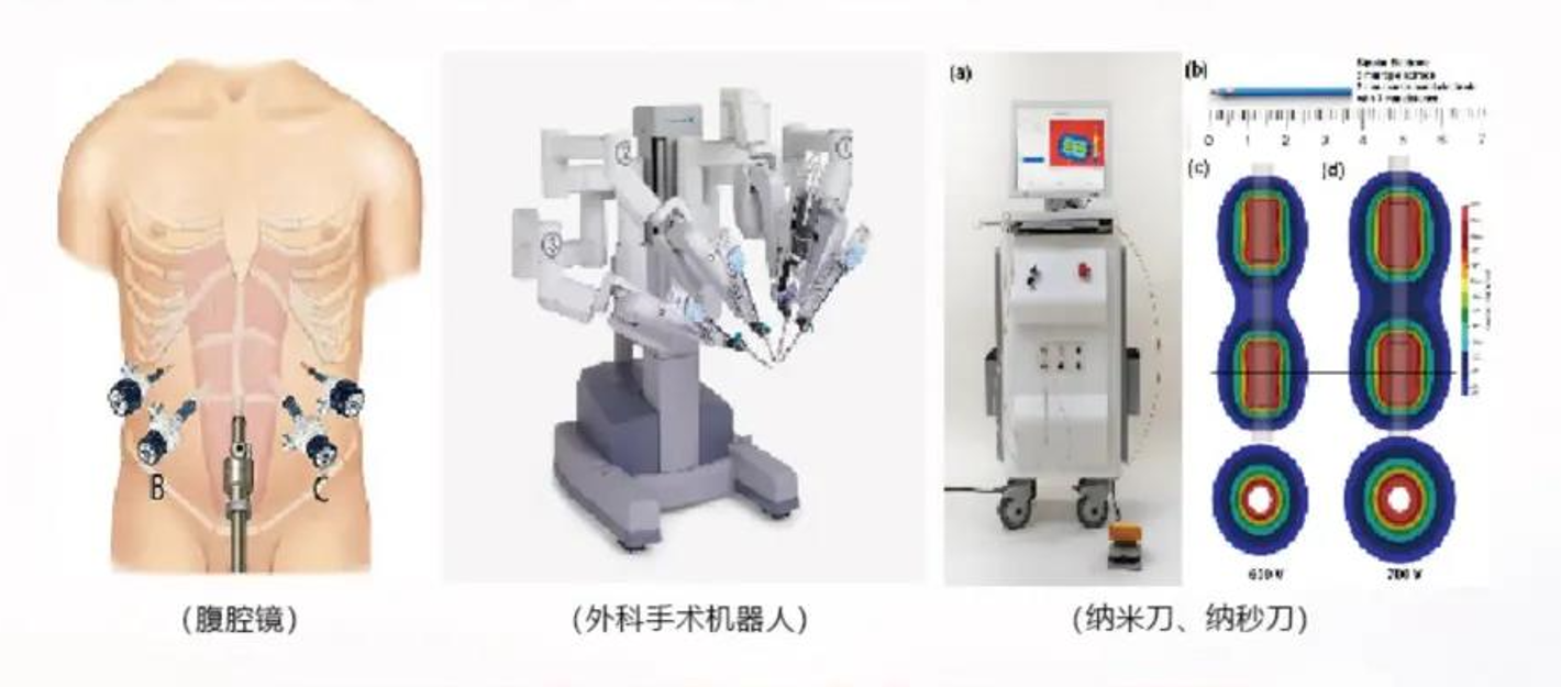 与“癌王”抢时间，要做“细”功夫